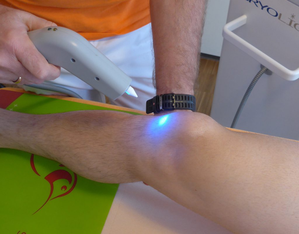 Kryotherapie / hyperbare Kältetherapie am Knie